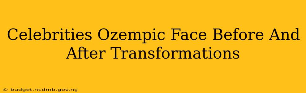 Celebrities Ozempic Face Before And After Transformations