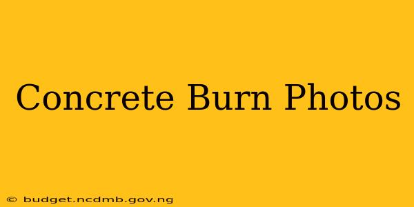 Concrete Burn Photos