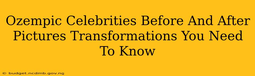 Ozempic Celebrities Before And After Pictures Transformations You Need To Know