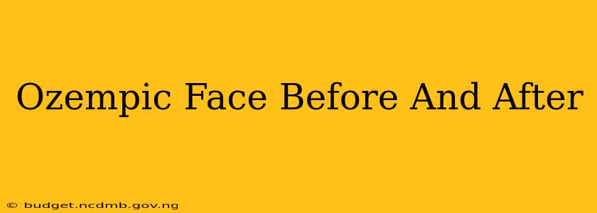 Ozempic Face Before And After