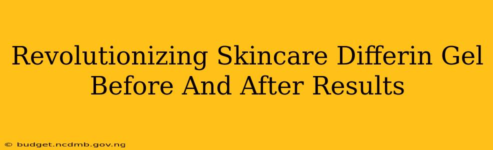 Revolutionizing Skincare Differin Gel Before And After Results