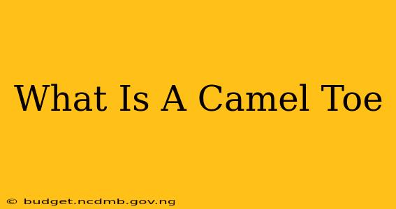 What Is A Camel Toe