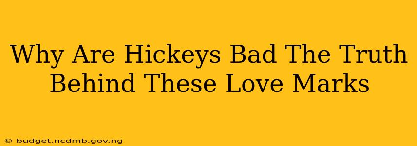 Why Are Hickeys Bad The Truth Behind These Love Marks